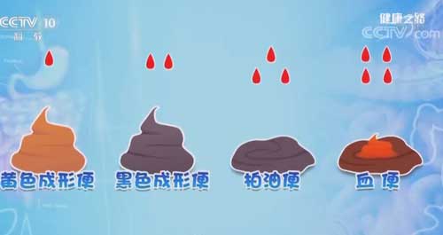 没有喝咖啡，呕吐物却是咖啡色！警惕这是胃出血
