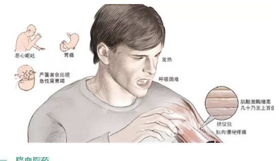 QQ截图20200610144712.png
