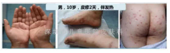 微信截图_20201104160025.png